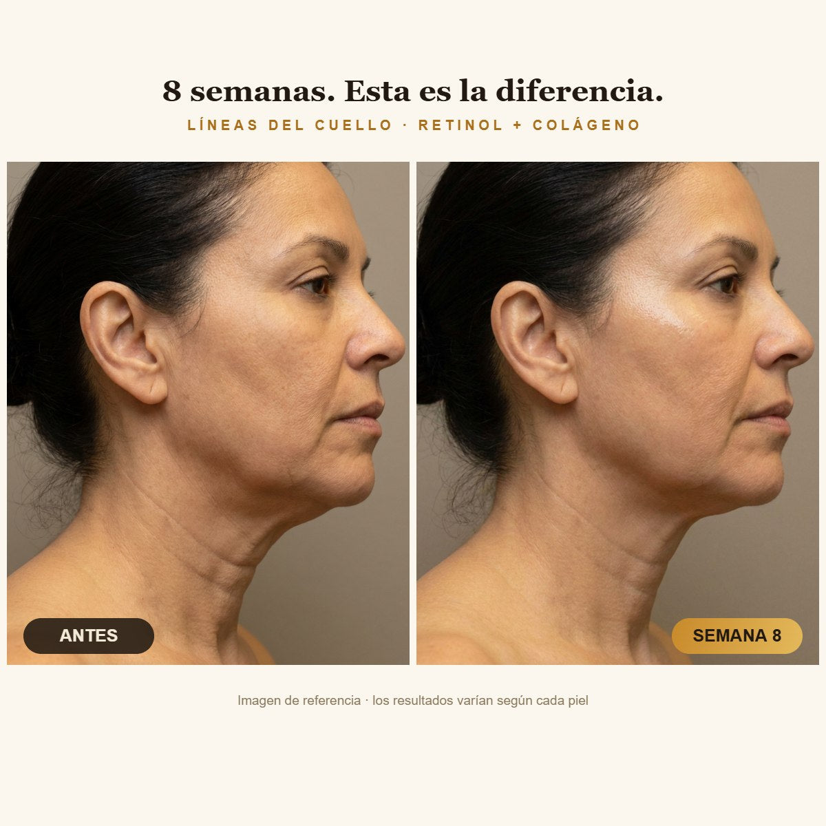 Antes y después en el cuello